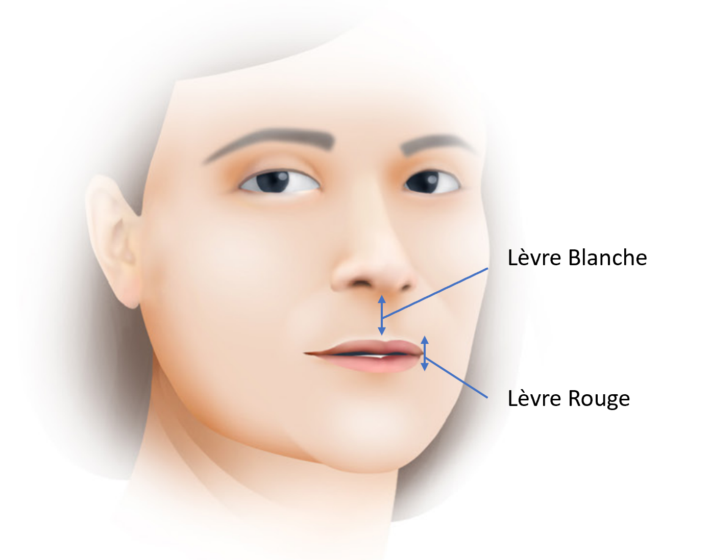 Lifting de la Lèvre Supérieure - Dr Yoni Madar, Spécialiste en Chirurgie.